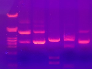 Gel_electrophoresis